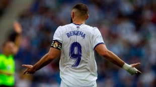 Benzema sigue tocado y el Mundial podría perjudicar al Real Madrid - Foto: Diario Gol